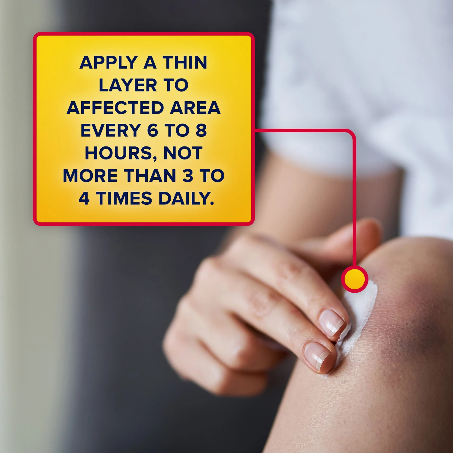 Aspercreme Lidocaine Pain Relief Cream Soothes Aggravated Nerves
